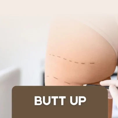 Butt UP