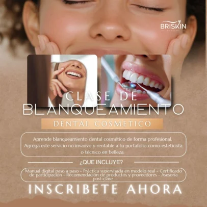 Clase de Blanqueamiento Dental Cosmético